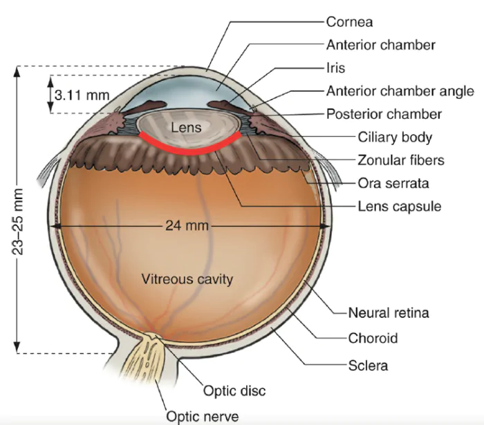 cápsula posterior do cristalino destacada em vermelho